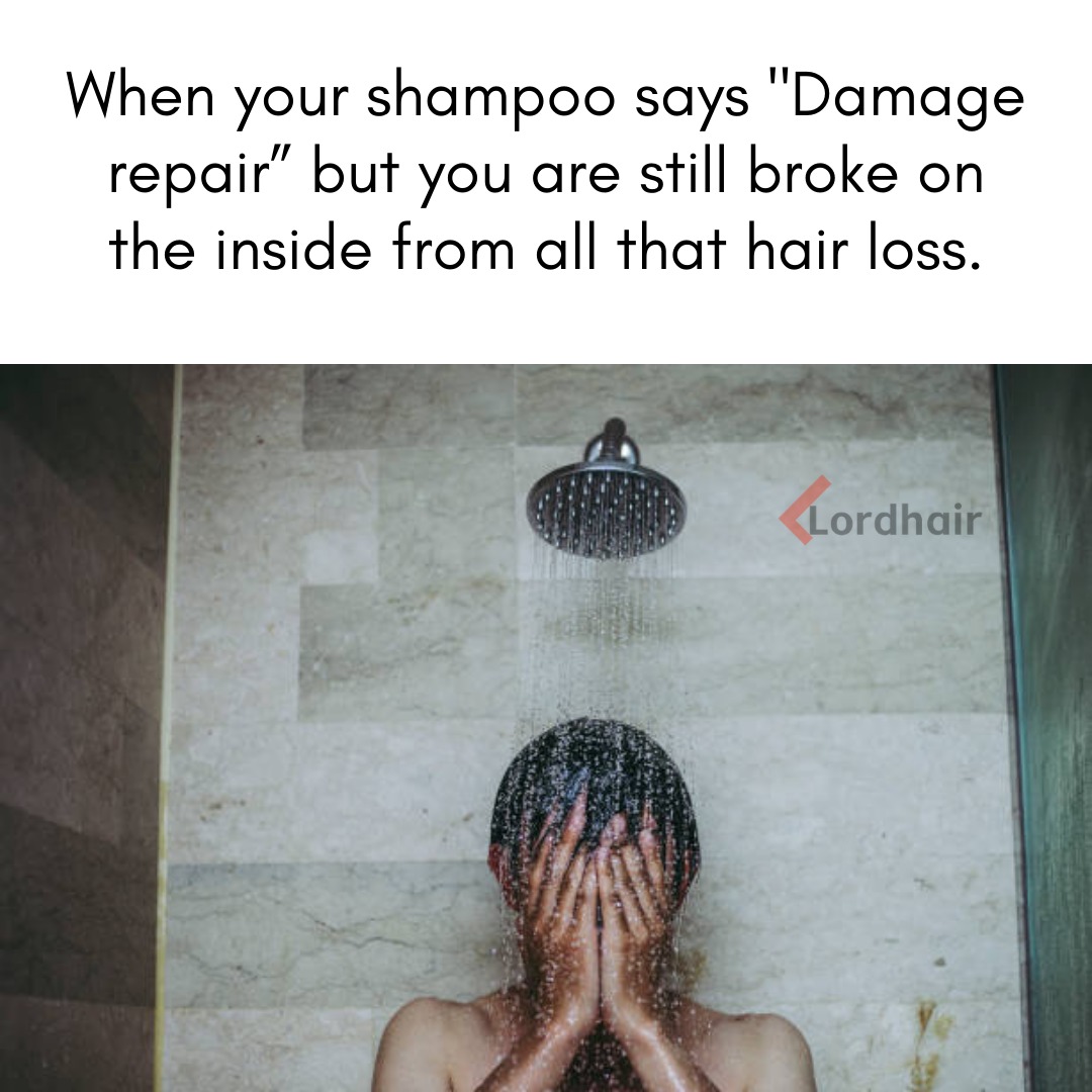 Just Hair Loss Problems - meme
