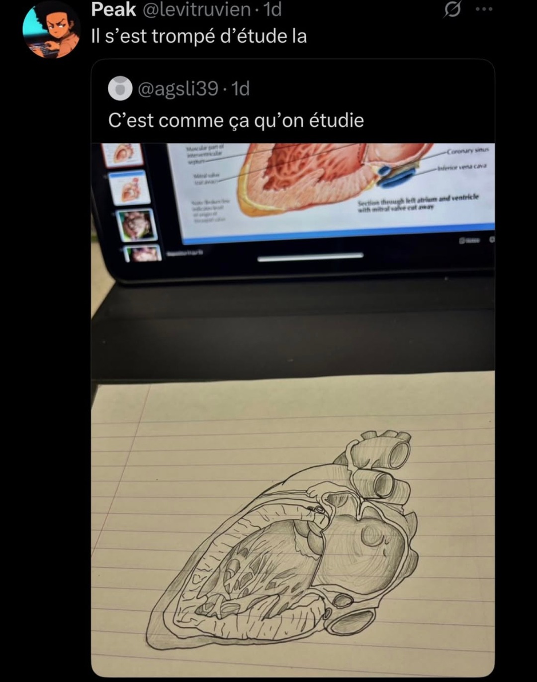 mème sur les études de médecine - meme