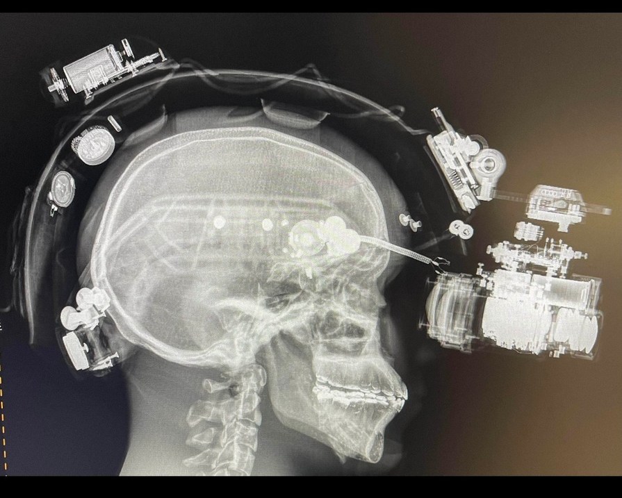 Guy got an x-ray while wearing nvgs (stolen from reddit) - meme