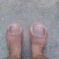Cursed feet