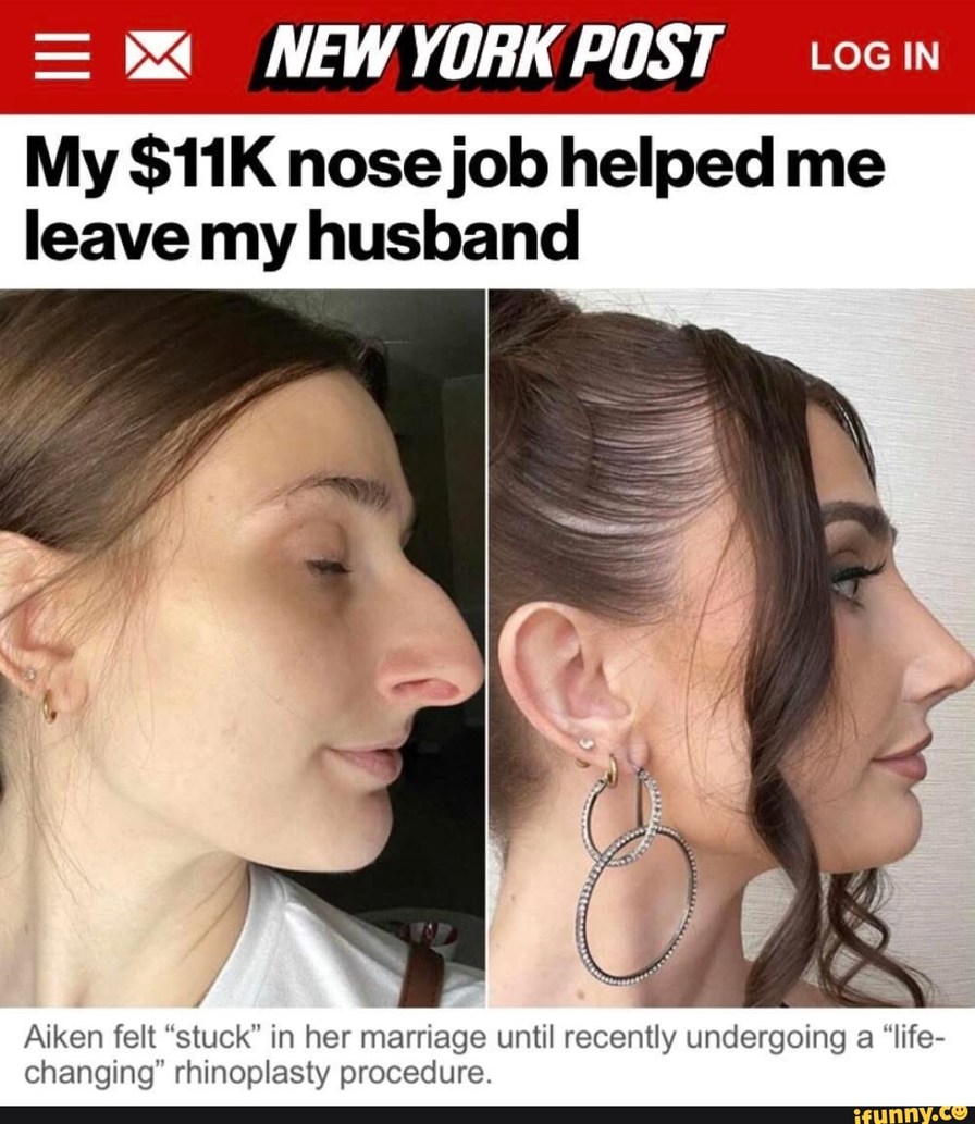 Her nosejob was the escape plan from her marriage - meme
