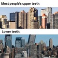 Upper teeth vs lower teeth