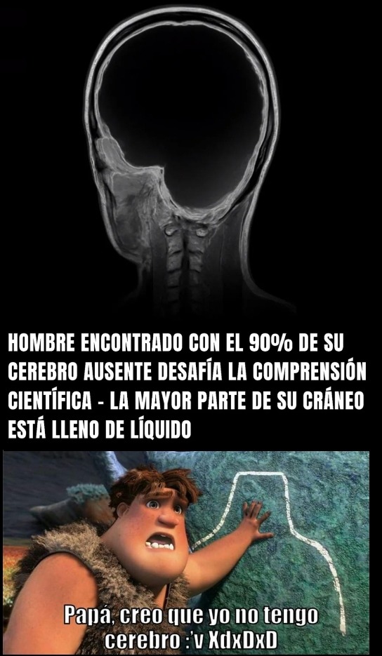 Es el verdadero papá creo que no tengo cerebro xddd - meme