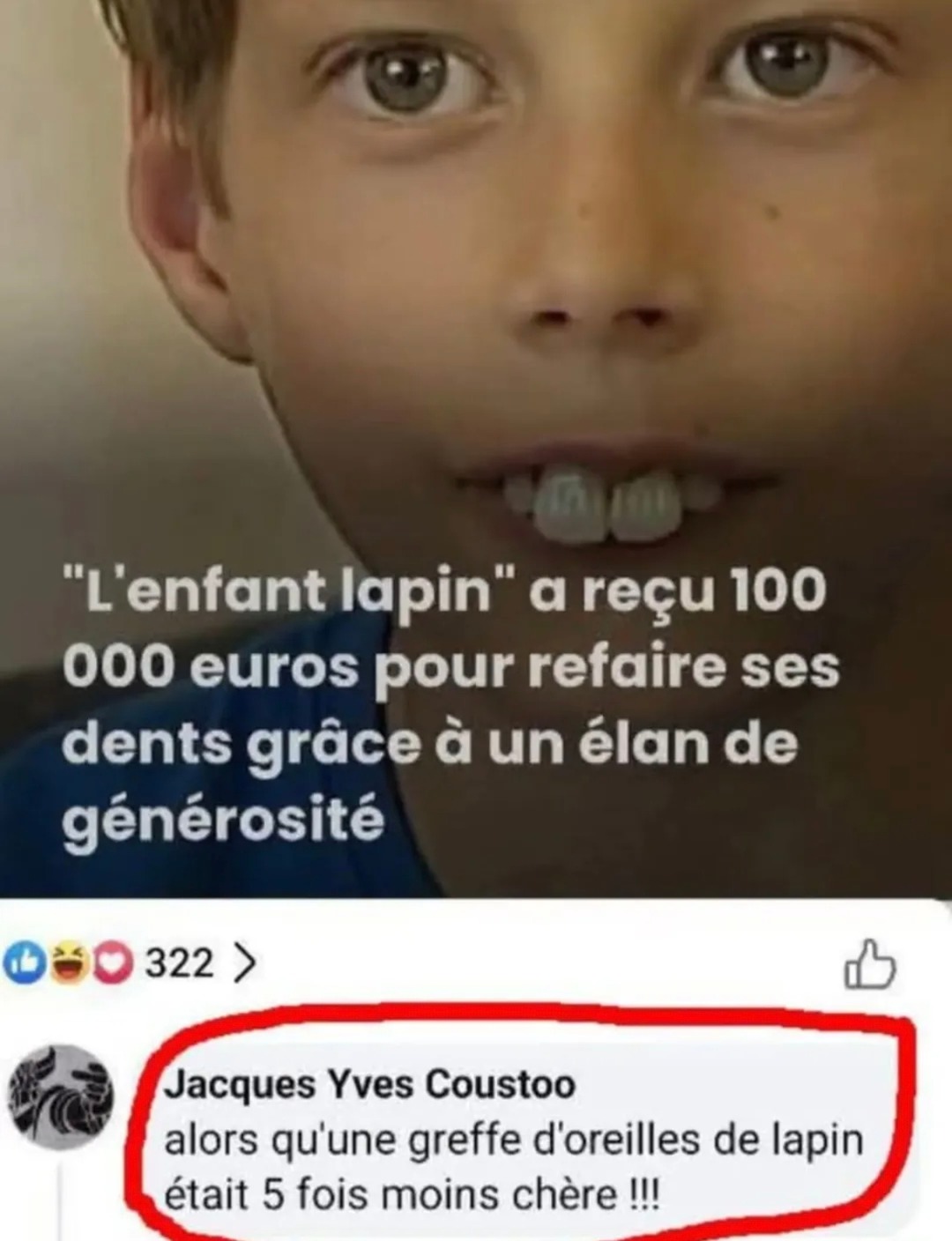 100 000€ pour ses dents... les oreilles de lapin pleurent - meme