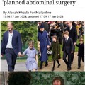 Kate Middleton  abdominal surgery meme