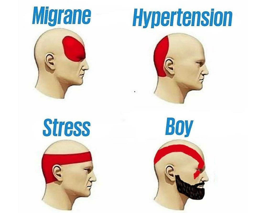 Tipos de dolores de cabeza - meme