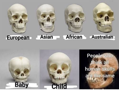 Osteology - meme