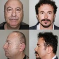Man receives facial surgery in Turkey