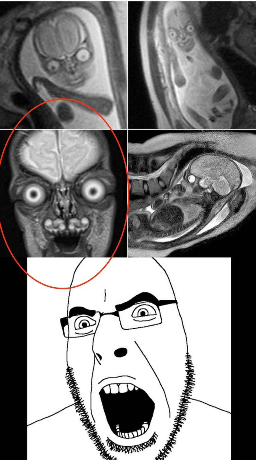 MRI of human babies in the womb - meme