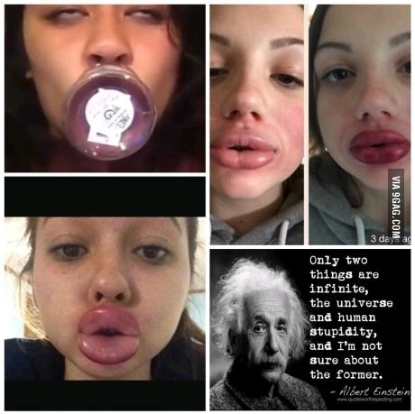 Kylie Jenner lips - meme