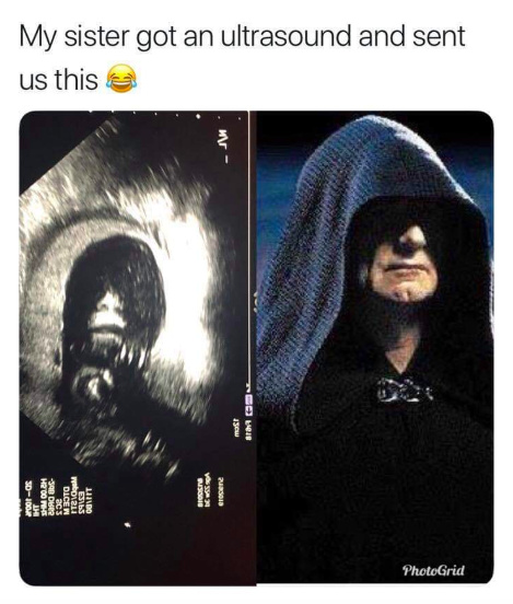 My sister got an ultrasound and sent us this - meme