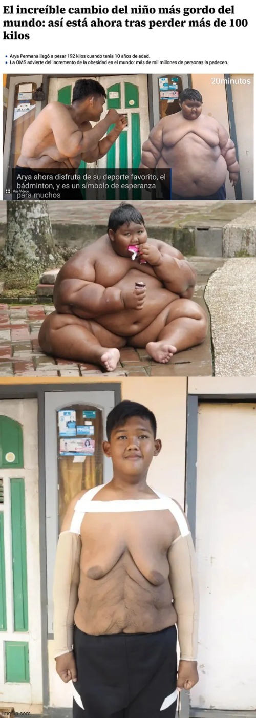 Transformación física del niño más gordo del mundo - meme