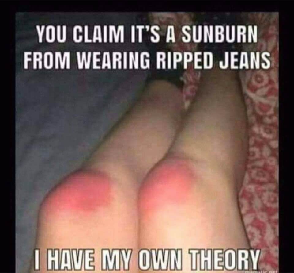 Sun Burn - meme