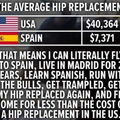 US vs Spain Healthcare System