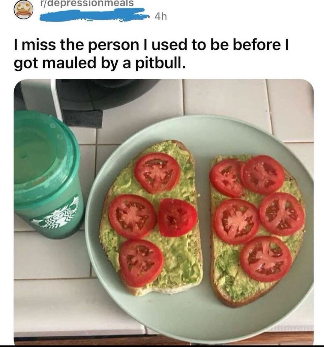 Missing old me after pitbull attack - meme