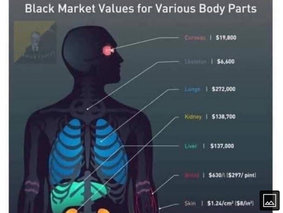 Just so you wanted to know what body parts to sell due to inflation - meme