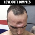 commented item thumbnail