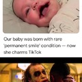 I think it was because tgat mother wanted to be tiktok famous and disfigured her baby