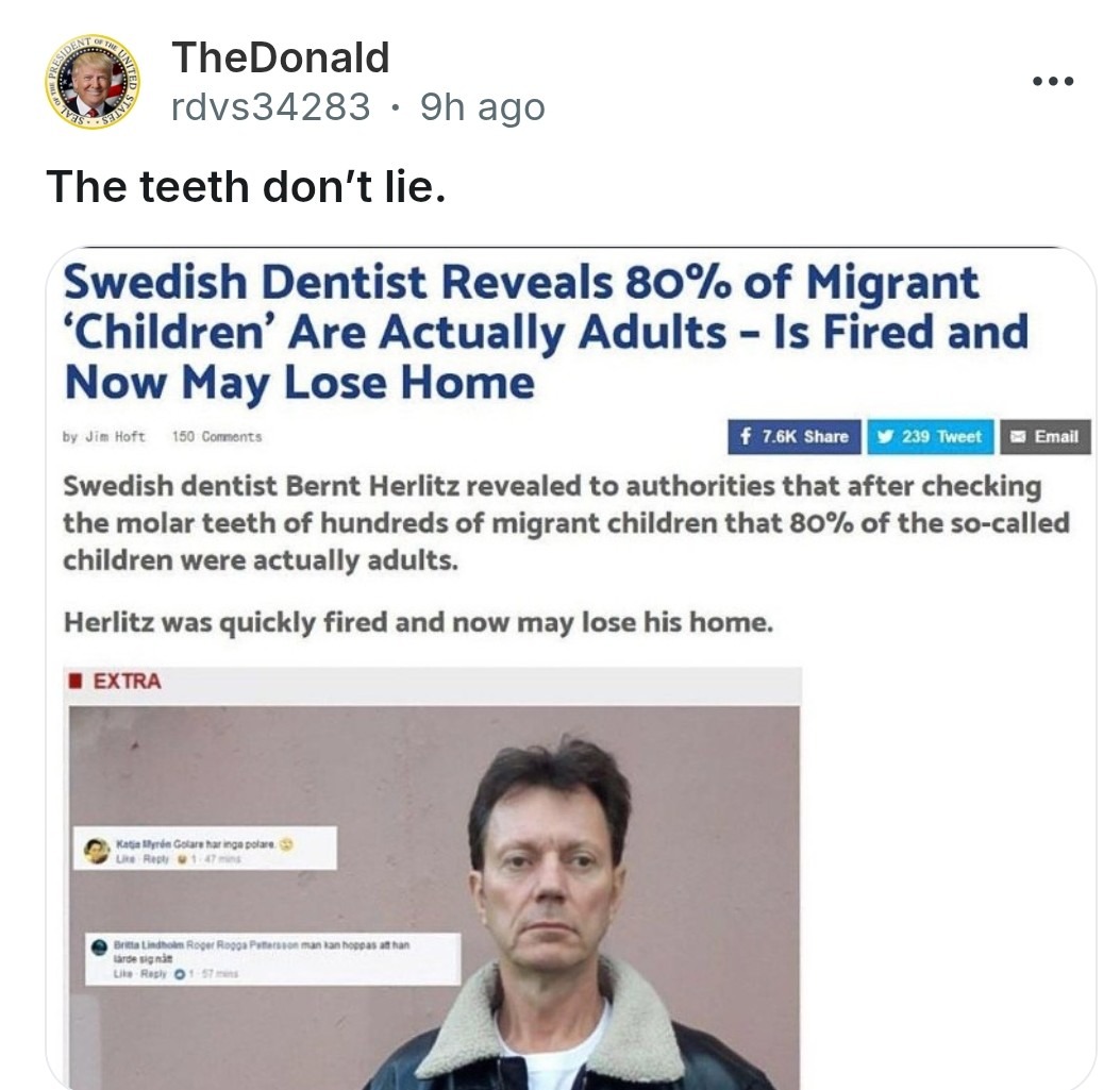 ﻿TheDonald rdvs34283 9h ago The teeth don’t lie_ Swedish Dentist Reveals 80% of Migrant ‘Children Are Actually Adults Is Fired and Now Lose Home Jim Hoft 150 Coments 7.6K Share Za9]eet Emall Swedish dentist Bernt Herlitz revealed to authorities that after checking the molar teeth of hundreds of migrant children that 80% of the sO-called children were actually adults: Herlitz was quickly fired and now may lose his home: EXTRA C4n d54nara nana Huet Mne Ra0 May