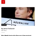 Neuralink wins US approval for human study