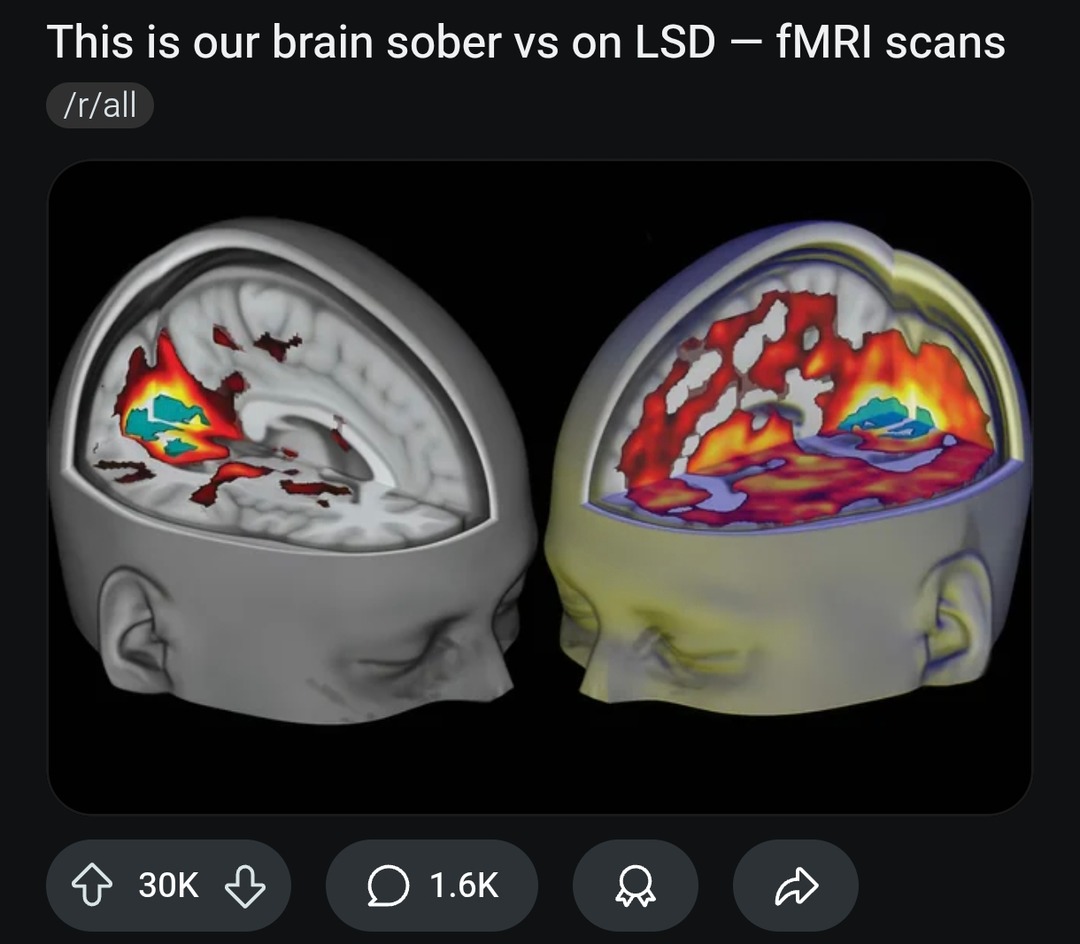 Your brain on vibes vs your brain on LSD - meme