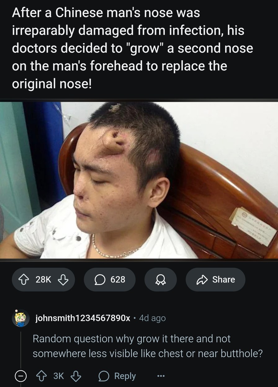 Grew a nose on his forehead and Reddit asked the real questions - meme