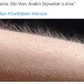 Anakin Skywalker is alive