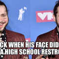 Back when his face didn’t look like a high school restroom door