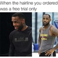 Hairline lost