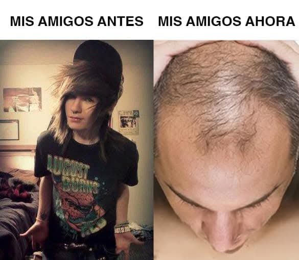 Los emos del pasado son los calvos de la actualidad - meme