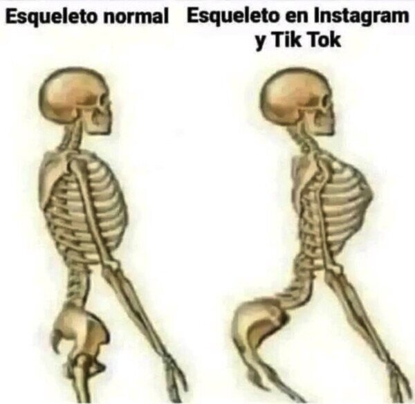 Esqueleto normal vs esqueleto influencer - meme