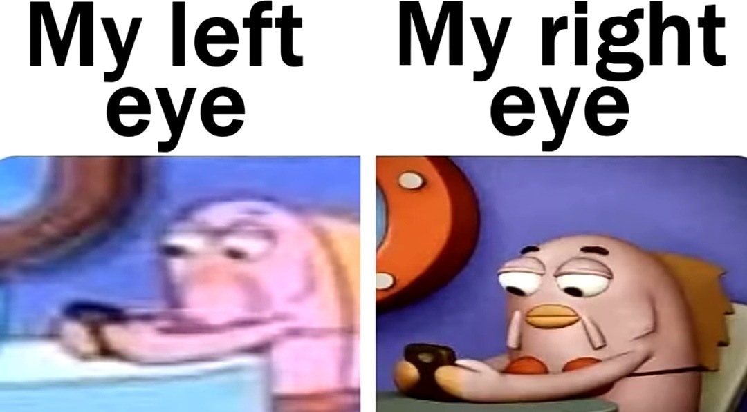 My eye - meme