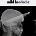 Headache :(