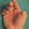 commented item thumbnail