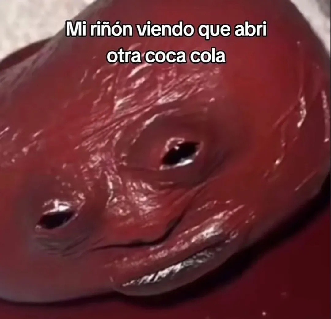 Mi riñón viendo cómo abro otra coca como si nada - meme